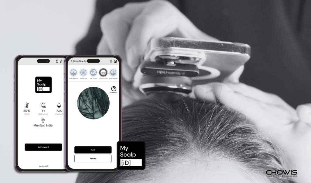Chowis Collaborates with L’Oréal Professionnel Paris in India to Revolutionize Hair Care Service 