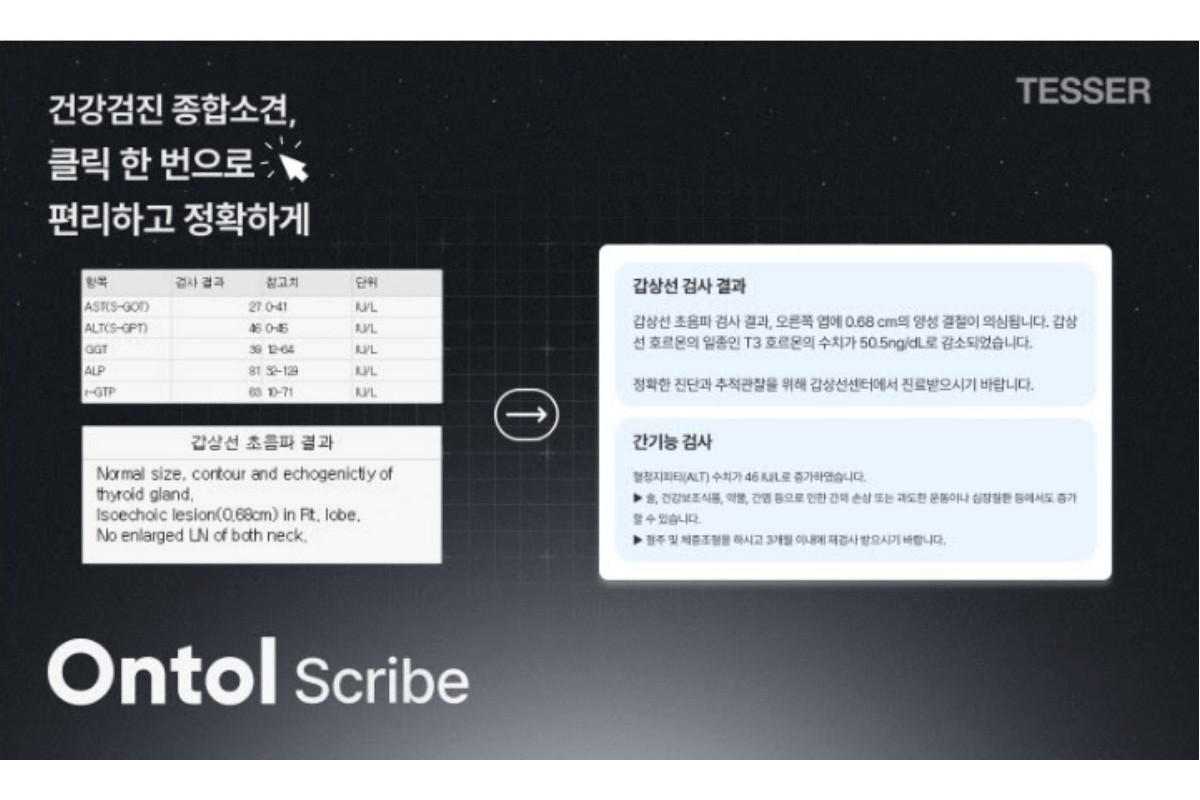 Ontol AI 의료 플랫폼 전문 ‘테서’, 건강검진 종합 소견 생성 AI ‘온톨 스크라이브’ 출시 - beSUCCESS